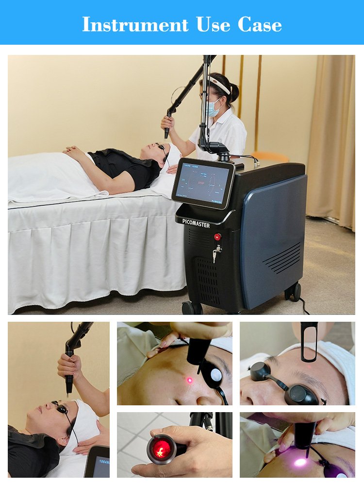 OEM picosecond laser for beauty salon equipment