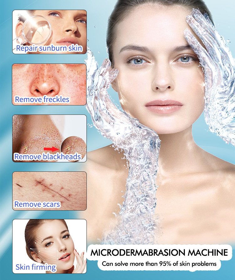 11 in 1 Hydra Dermabrasion RF Facial Beauty Machine M39 - Image 10