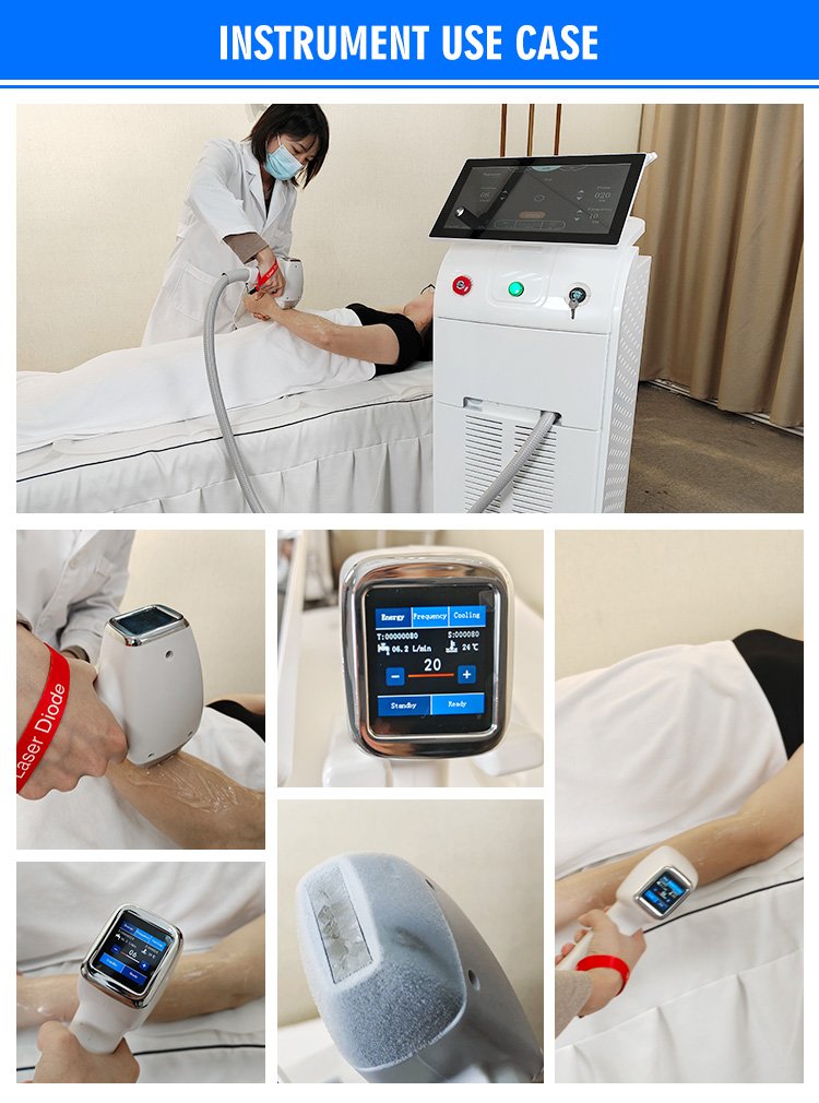 Professional 808nm Diode Laser Hair Removal Machine - Image 11