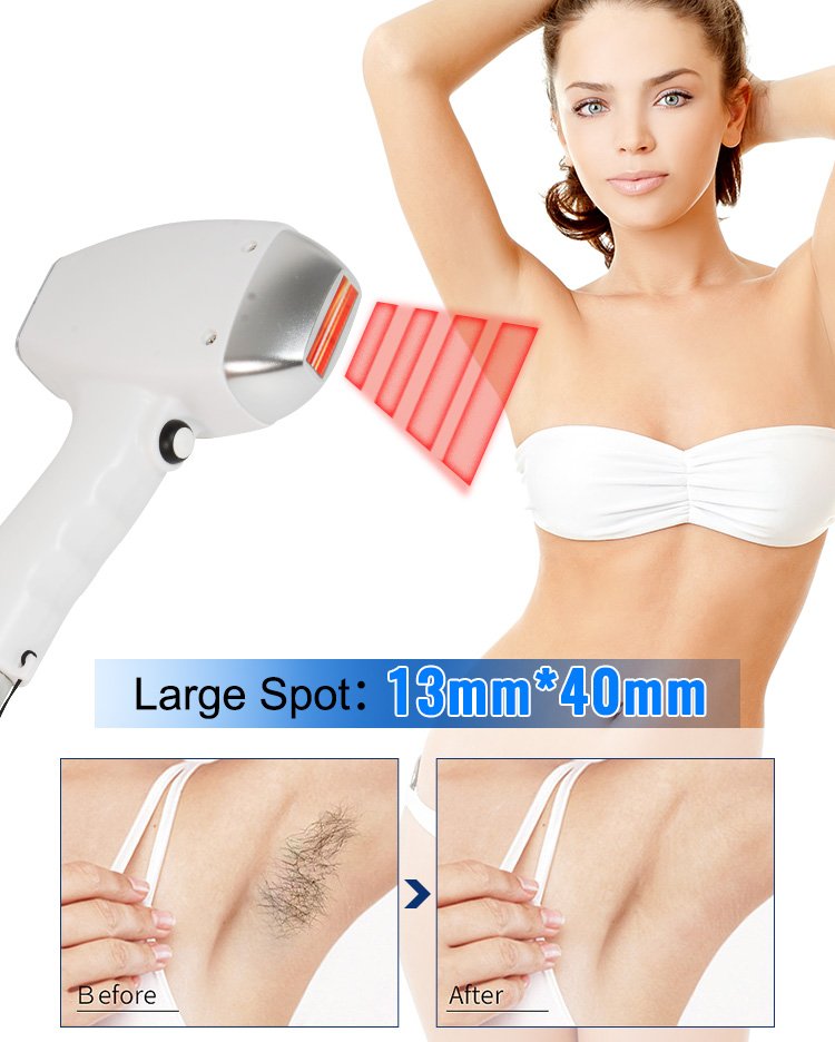 Professional 808nm Diode Laser Hair Removal Machine - Image 5